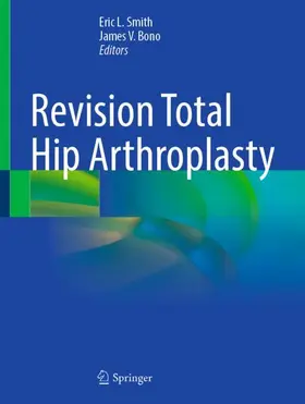 Smith / Bono |  Revision Total Hip Arthroplasty | Buch |  Sack Fachmedien