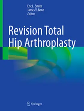 Smith / Bono |  Revision Total Hip Arthroplasty | eBook | Sack Fachmedien