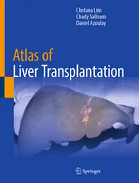 Lim / Salloum / Azoulay |  Atlas of Liver Transplantation | eBook | Sack Fachmedien