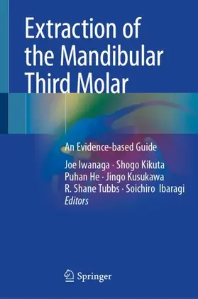Iwanaga / Kikuta / Ibaragi |  Extraction of the Mandibular Third Molar | Buch |  Sack Fachmedien