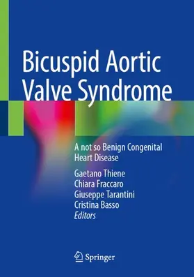Thiene / Fraccaro / Tarantini |  Bicuspid Aortic Valve Syndrome | Buch |  Sack Fachmedien