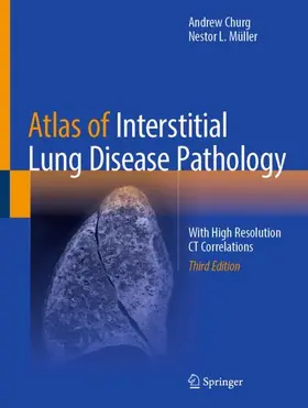 Müller / Churg |  Atlas of Interstitial Lung Disease Pathology | Buch |  Sack Fachmedien