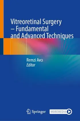 Avci / Avci | Vitreoretinal Surgery - Fundamental and Advanced Techniques | Buch | 978-3-031-87575-5 | www.sack.de