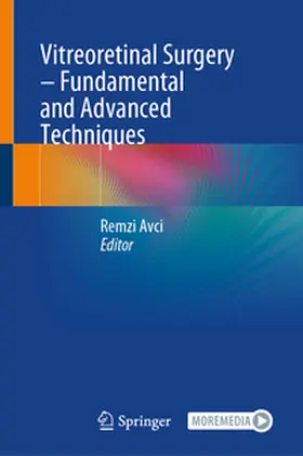 Avci |  Vitreoretinal Surgery – Fundamental and Advanced Techniques | eBook | Sack Fachmedien