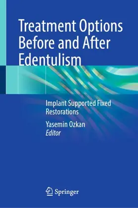 Ozkan | Treatment Options Before and After Edentulism | Buch | 978-3-031-96878-5 | www.sack.de