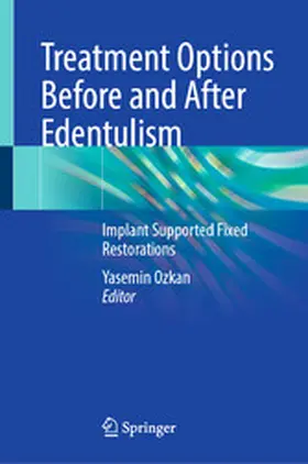 Ozkan |  Treatment Options Before and After Edentulism | eBook | Sack Fachmedien