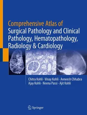 Kohli / Chhabra / Passi |  Comprehensive Atlas of Surgical Pathology and Clinical Pathology, Hematopathology, Radiology & Cardiology | Buch |  Sack Fachmedien