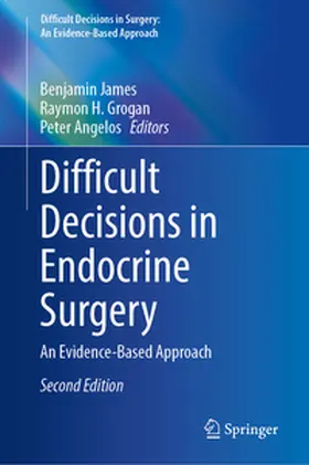 James / Grogan / Angelos |  Difficult Decisions in Endocrine Surgery | eBook | Sack Fachmedien