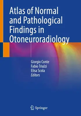 Conte / Triulzi / Scola |  Atlas of Normal and Pathological Findings in Otoneuroradiology | Buch |  Sack Fachmedien