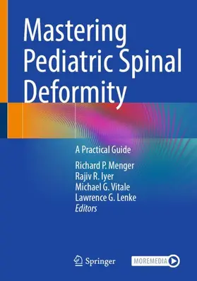 Menger / Iyer / Vitale |  Mastering Pediatric Spinal Deformity | Buch |  Sack Fachmedien