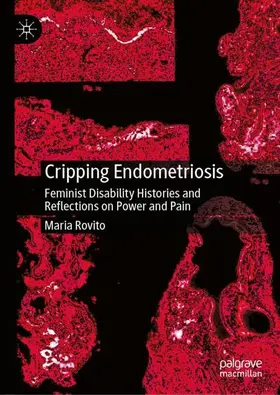 Rovito |  Cripping Endometriosis | Buch |  Sack Fachmedien