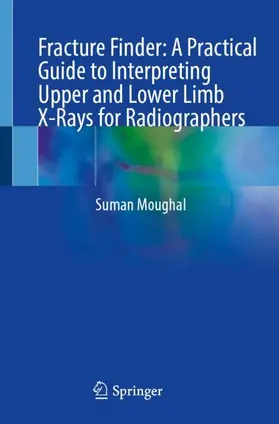 Moughal | Fracture Finder: A Practical Guide to Interpreting Upper and Lower Limb X-Rays for Radiographers | Buch | 978-3-032-17323-2 | www.sack.de