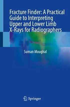 Moughal |  Fracture Finder: A Practical Guide to Interpreting Upper and Lower Limb X-Rays for Radiographers | eBook | Sack Fachmedien