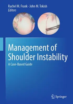 Frank / Tokish |  Management of Shoulder Instability | Buch |  Sack Fachmedien