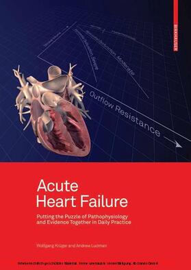 Krüger / Ludman | Acute Heart Failure | E-Book | sack.de
