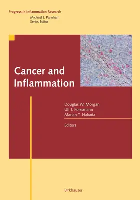 Morgan / Nakada / Forssman |  Cancer and Inflammation | Buch |  Sack Fachmedien
