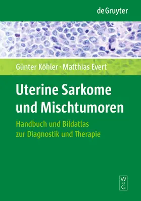 Evert / Köhler |  Uterine Sarkome und Mischtumoren | Buch |  Sack Fachmedien