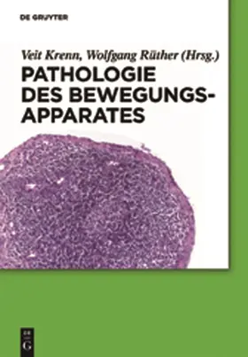 Rüther / Krenn | Pathologie des Bewegungsapparates | Buch | 978-3-11-022189-3 | sack.de