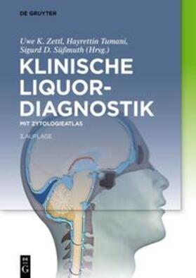 Zettl / Lehmitz / Tumani | Klinische Liquordiagnostik | Buch | sack.de