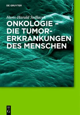 Sedlacek |  Onkologie - die Tumorerkrankungen des Menschen | eBook | Sack Fachmedien