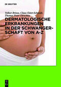 Briese / Oster-Schmidt / Dirschka |  Dermatologische Erkrankungen in der Schwangerschaft von A-Z | Buch |  Sack Fachmedien