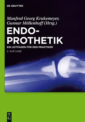 Möllenhoff / Krukemeyer | Endoprothetik | Buch | 978-3-11-028018-0 | www.sack.de