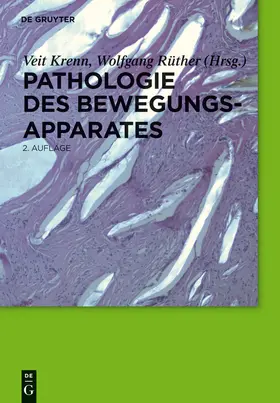 Krenn / Rüther | Pathologie des Bewegungsapparates | Buch | 978-3-11-028596-3 | sack.de