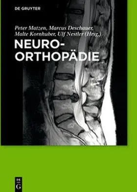 Matzen / Deschauer / Kornhuber |  Neuroorthopädie | Buch |  Sack Fachmedien