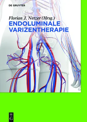 Netzer | Endoluminale Varizentherapie | Buch | 978-3-11-035288-7 | www.sack.de