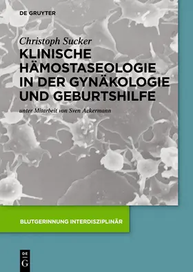 Sucker | Klinische Hämostaseologie in der Gynäkologie und Geburtshilfe | Buch | 978-3-11-041945-0 | www.sack.de