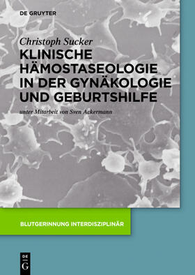 Sucker | Klinische Hämostaseologie in der Gynäkologie und Geburtshilfe | Buch | 978-3-11-041945-0 | sack.de