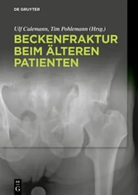 Culemann / Pohlemann | Beckenfraktur beim älteren Patienten | E-Book | www.sack.de