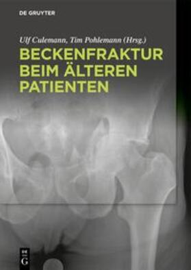 Culemann / Pohlemann | Beckenfraktur beim älteren Patienten | E-Book | sack.de