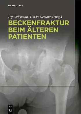 Culemann / Pohlemann |  Beckenfraktur beim älteren Patienten | eBook | Sack Fachmedien