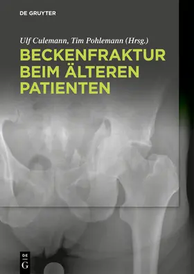 Culemann / Pohlemann | Beckenfraktur beim älteren Patienten | Buch | sack.de