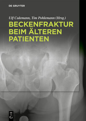 Culemann / Pohlemann | Beckenfraktur beim älteren Patienten | Buch | 978-3-11-042648-9 | sack.de