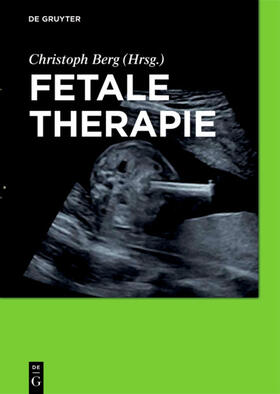 Berg | Fetale Therapie | E-Book | sack.de