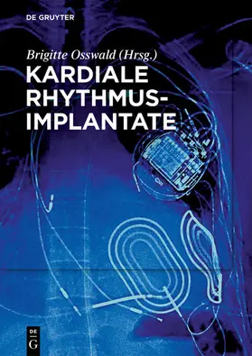 Osswald | Kardiale Rhythmusimplantate | E-Book | sack.de