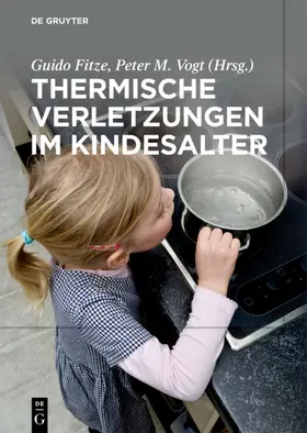 Fitze / Vogt |  Thermische Verletzungen im Kindesalter | eBook | Sack Fachmedien