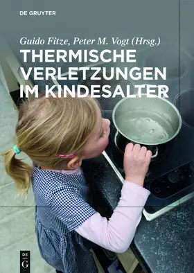 Fitze / Vogt |  Thermische Verletzungen im Kindesalter | eBook | Sack Fachmedien