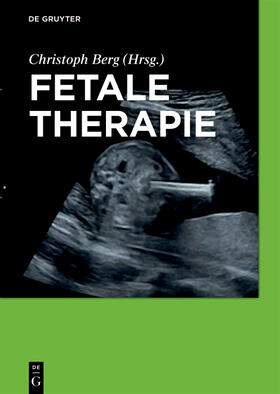 Berg | Fetale Therapie | Buch | 978-3-11-043841-3 | sack.de
