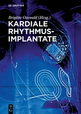 Osswald | Kardiale Rhythmusimplantate | Buch | sack.de