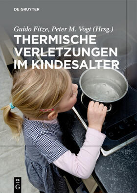 Fitze / Keil / Vogt | Thermische Verletzungen im Kindesalter | Buch | 978-3-11-044284-7 | sack.de