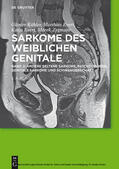 Köhler / Evert / Zygmunt |  Andere seltene Sarkome,  Mischtumoren, genitale Sarkome und Schwangerschaft | eBook | Sack Fachmedien