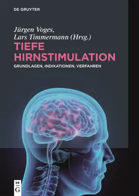 Timmermann / Voges |  Tiefe Hirnstimulation | Buch |  Sack Fachmedien