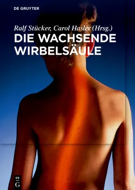 Stücker / Hasler |  Die wachsende Wirbelsäule | Buch |  Sack Fachmedien