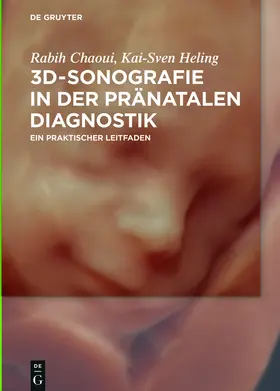 Chaoui / Heling | 3D-Sonografie in der pränatalen Diagnostik | Buch | 978-3-11-047131-1 | sack.de