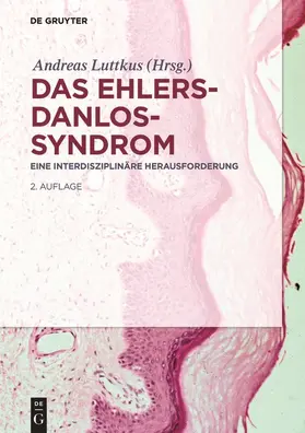 Luttkus | Das Ehlers-Danlos-Syndrom | Buch | 978-3-11-047364-3 | www.sack.de