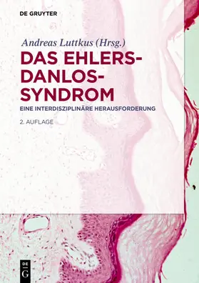 Luttkus | Das Ehlers-Danlos-Syndrom | E-Book | www.sack.de