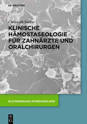 Sucker / Schüttler-Janikulla |  Klinische Hämostaseologie für Zahnärzte und Oralchirurgen | Buch |  Sack Fachmedien